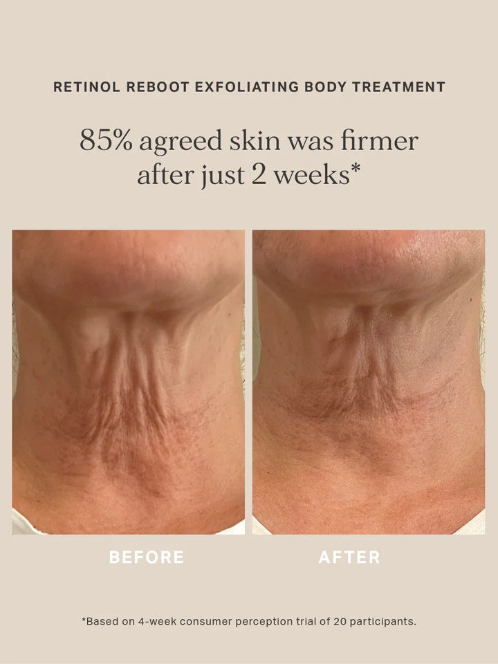 Retinol Reboot Exfoliating Body Treatment